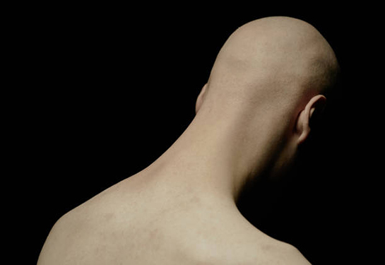 Rear view of sorrowful man with bald head and face hidden